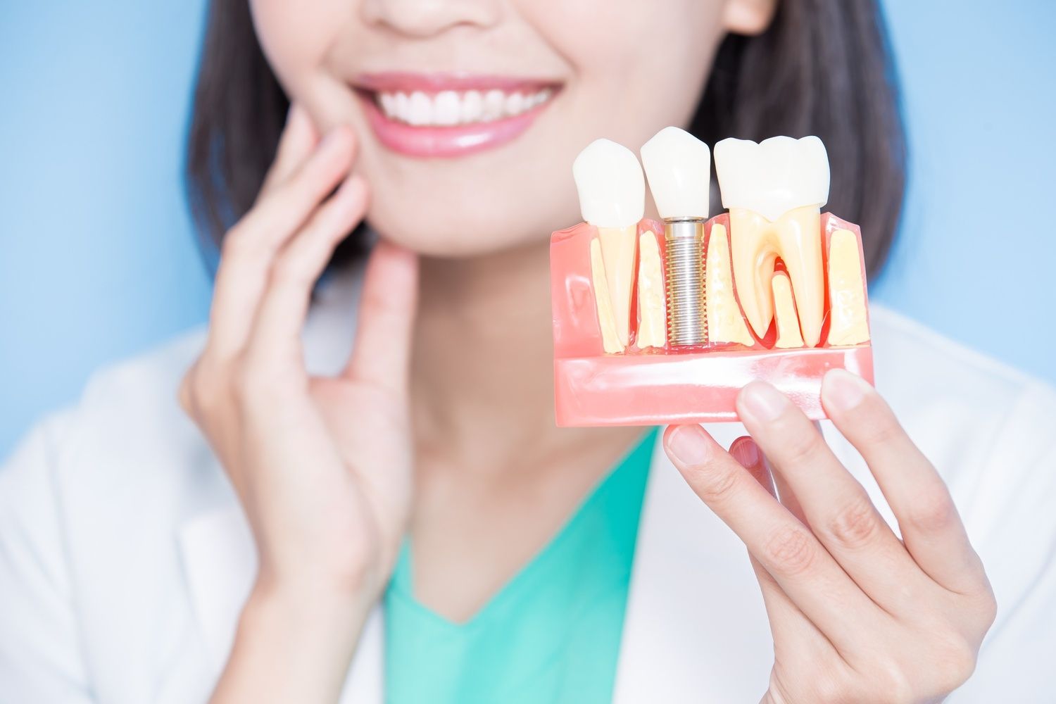 How Long Should Dental Implants Last Compared to Other Tooth Replacement Options (2).jpg