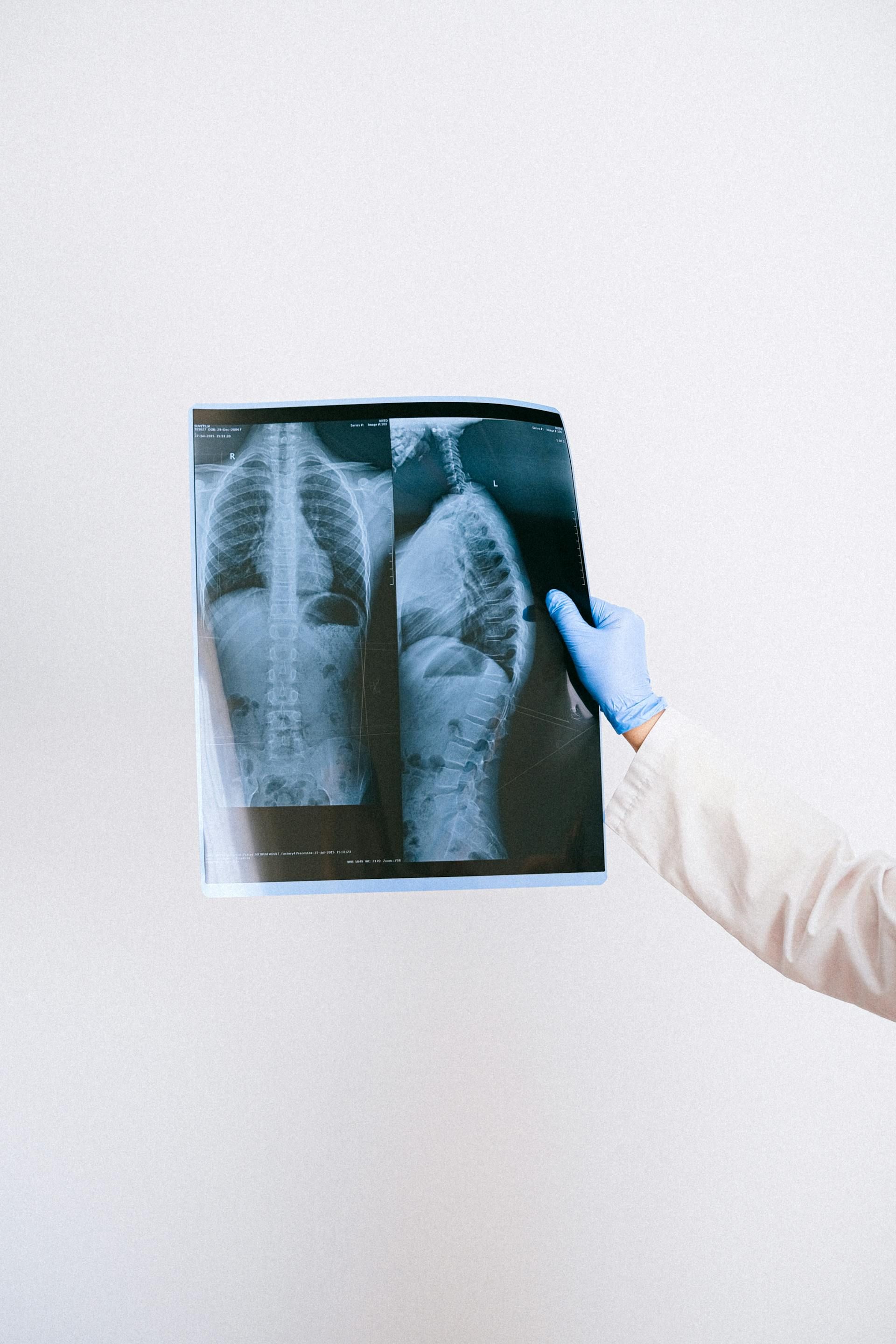 What to Know About Modern X-Ray Services.jpg
